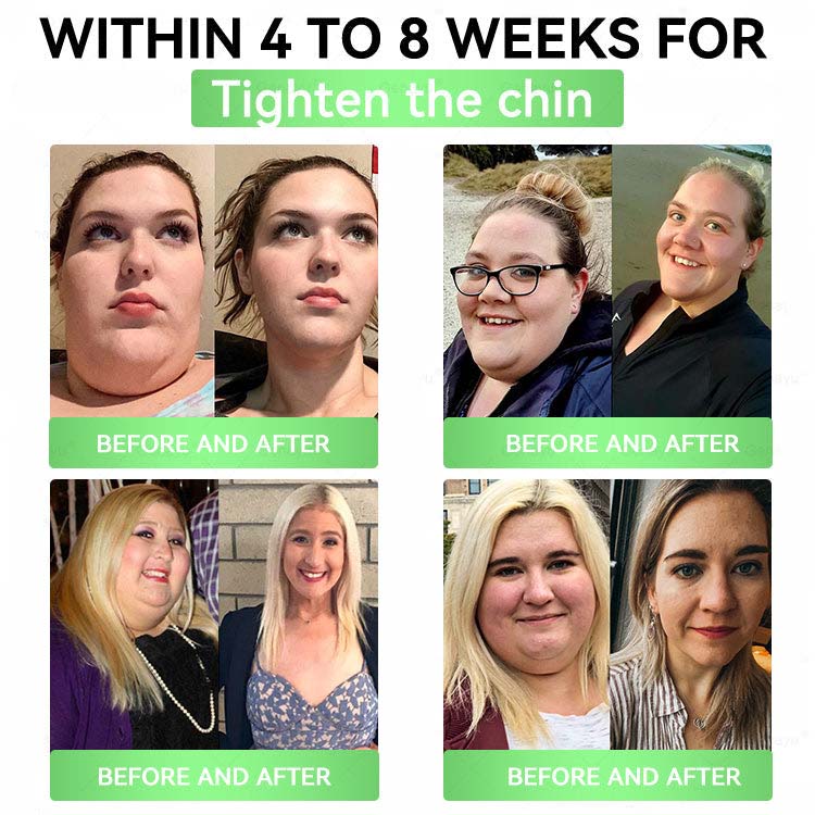 🌟 Alcuras™ Moringa x Berberine x AMPK 8-Benefit Slimming & Metabolic Nano Microneedle Patch us Just once a day Visible changes in 7 days For obesity, loose skin, diabetes, sleep apnea, joint issues, and more