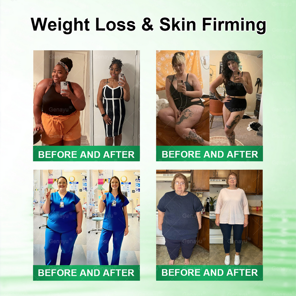 🌟 Alcuras™ Moringa x Berberine x AMPK 8-Benefit Slimming & Metabolic Nano Microneedle Patch us Just once a day Visible changes in 7 days For obesity, loose skin, diabetes, sleep apnea, joint issues, and more